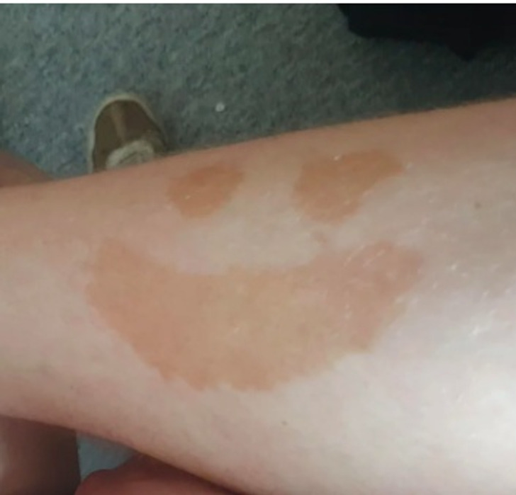 “My friend has a weird birthmark.”