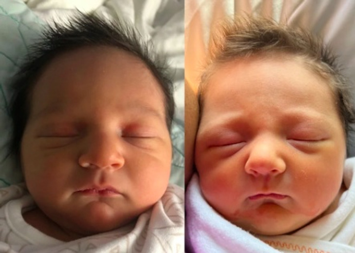 “Son (left) and daughter born 17 months apart”