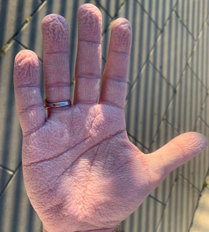 “My friend’s hand after swimming”