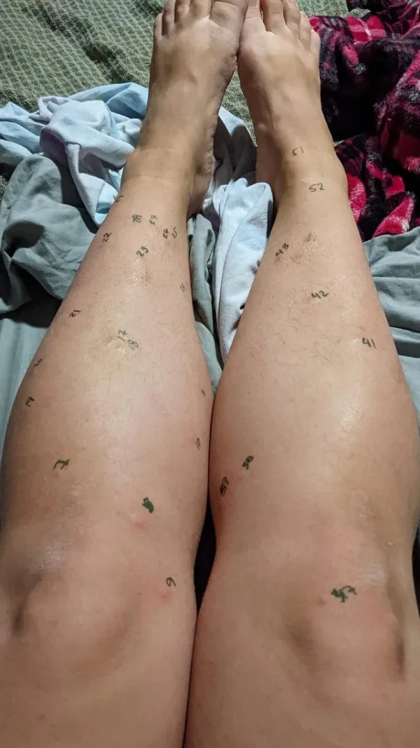 “Took my kids swimming and came home with a grand total of 65 mosquito bites. My kids had 2 between the three of them.”