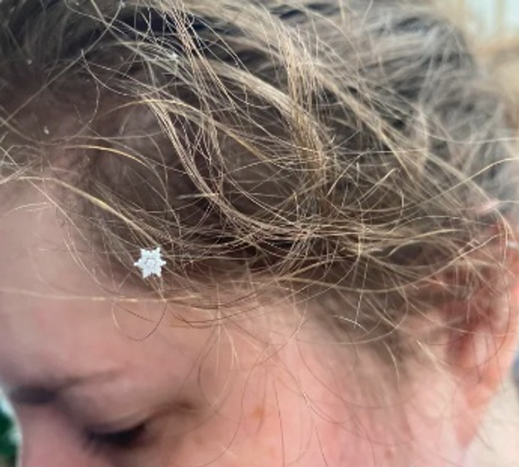 “This perfect snowflake that landed on my girlfriend last year”