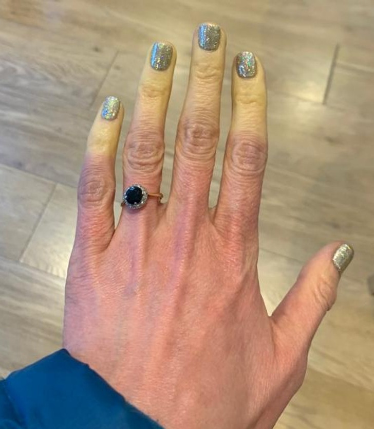 “My friend has Raynaud’s and loses all color in her fingers when it’s cold.”