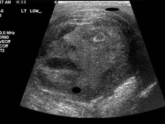ultrasound testicles -
