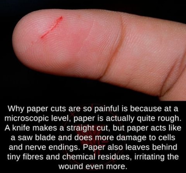 fascinating facts - microscope paper cut - Why paper cuts are so painful is because at a microscopic level, paper is actually quite rough. A knife makes a straight cut, but paper acts a saw blade and does more damage to cells and nerve endings. Paper also