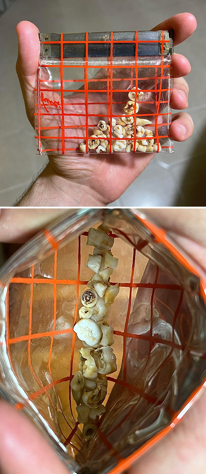 This Old Coin Purse Full Of Teeth I Just Found In My Basement
