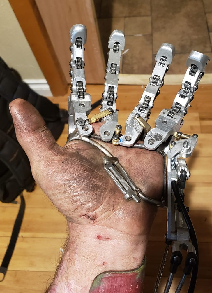 “My mechanical prosthetic hand”