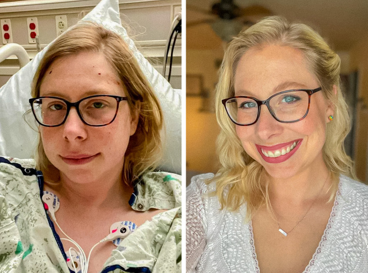 “These 2 photos were taken one year apart. Today marks one year since my first ’brainniversary.’”