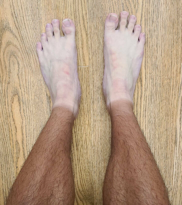 “My sock tan looks like I have socks on.”