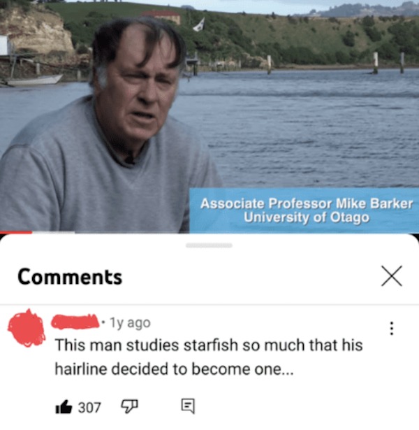 Funny Comments - This man studies starfish so much that his hairline decided to become one..