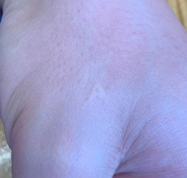 “I have a scar on my hand of the letter A.”