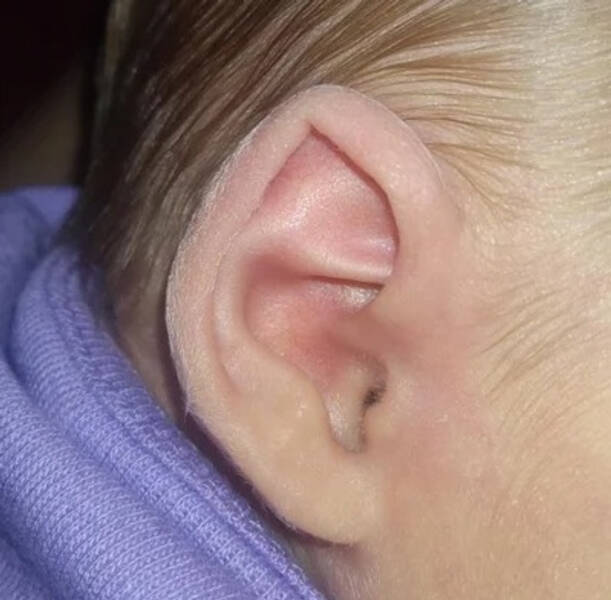 unique body parts - ear