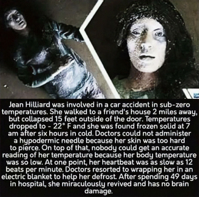 creepy and wtf pics - jean hilliard real frozen - Jean Hilliard was involved in a car accident in subzero temperatures. She walked to a friend's house 2 miles away, but collapsed 15 feet outside of the door. Temperatures dropped to 22 F and she was found 