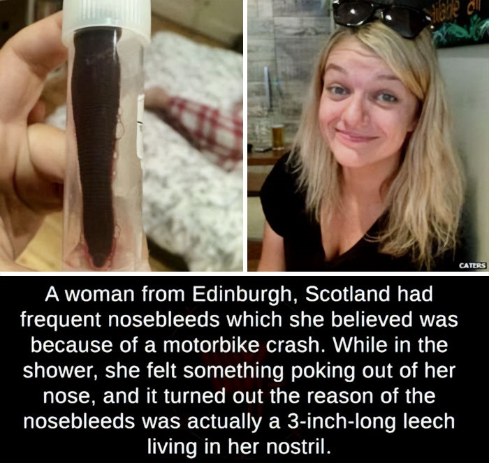 creepy and wtf pics - ll never go there river - A woman from Edinburgh, Scotland had frequent nosebleeds which she believed was because of a motorbike crash. While in the shower, she felt something poking out of her nose, and it turned out the reason of t