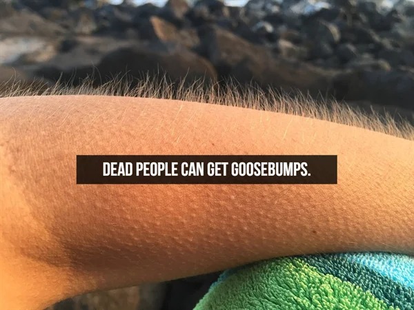 fascinating facts - goosebumps under microscope - Dead People Can Get Goosebumps.