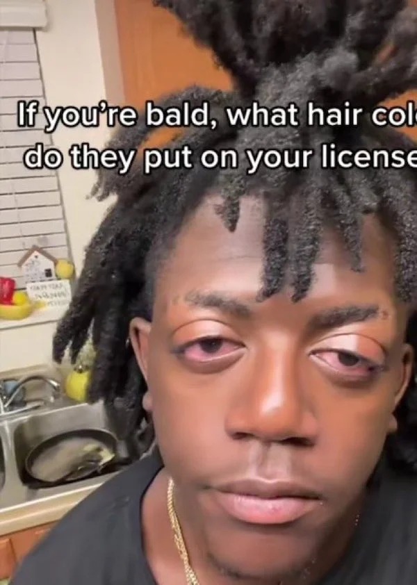 relatable memes - dreadlocks - If you're bald, what hair col do they put on your license