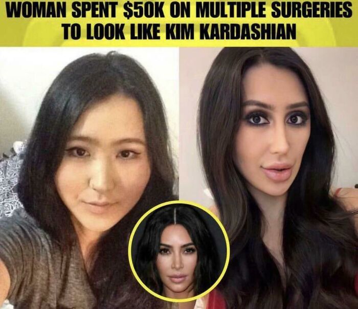 cringe pics - cherrie lee south korean - Woman Spent $50K On Multiple Surgeries To Look Kim Kardashian