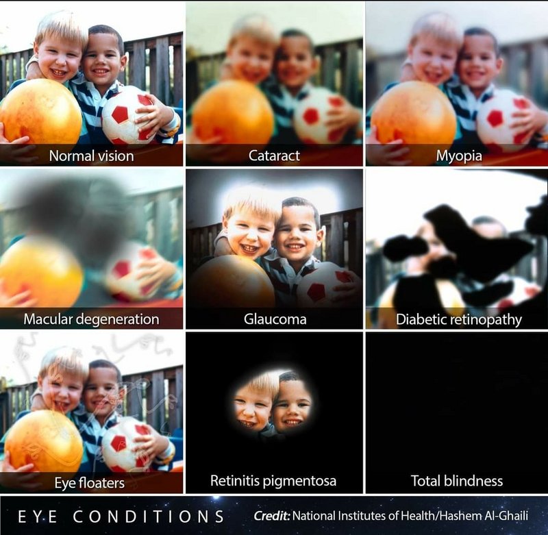 What different eye conditions look like
