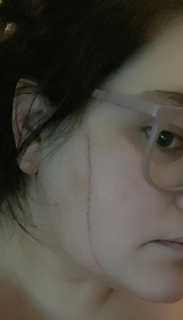 “My cat tried to use my face as a jumping board while I was sleeping..”