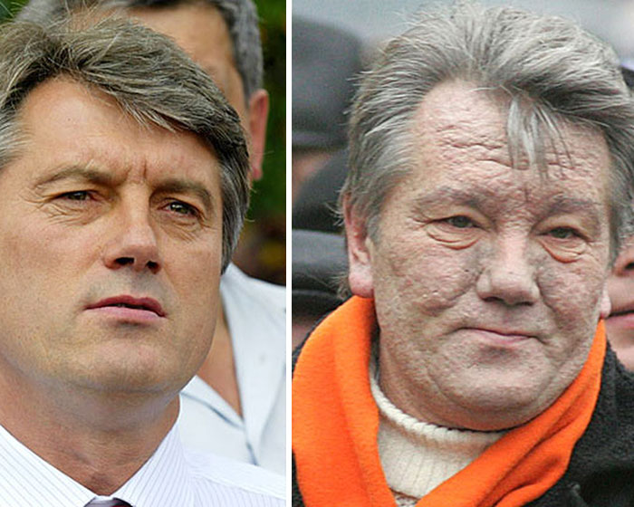 Viktor Yushchenko Before And After His Poisoning By Vladimir Putin In 2004. He And His Family Believe The Assassination Attempt Was Ordered By Moscow When He Attempted To Steer Ukraine To Closer Integration With Europe
