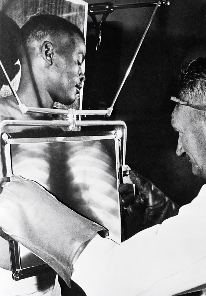 Each Day At The End Of The Shift, The Miners Would Have To Go Through The X-Ray Machine For Inspection. Some Miners Would Swallow Diamonds, Even Hide Them In Self-Inflicted Incisions In Their Legs, South Africa 1954