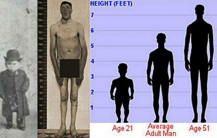 Adam Rainer was the only person in recorded history to have been both a dwarf and a giant in one lifetime
