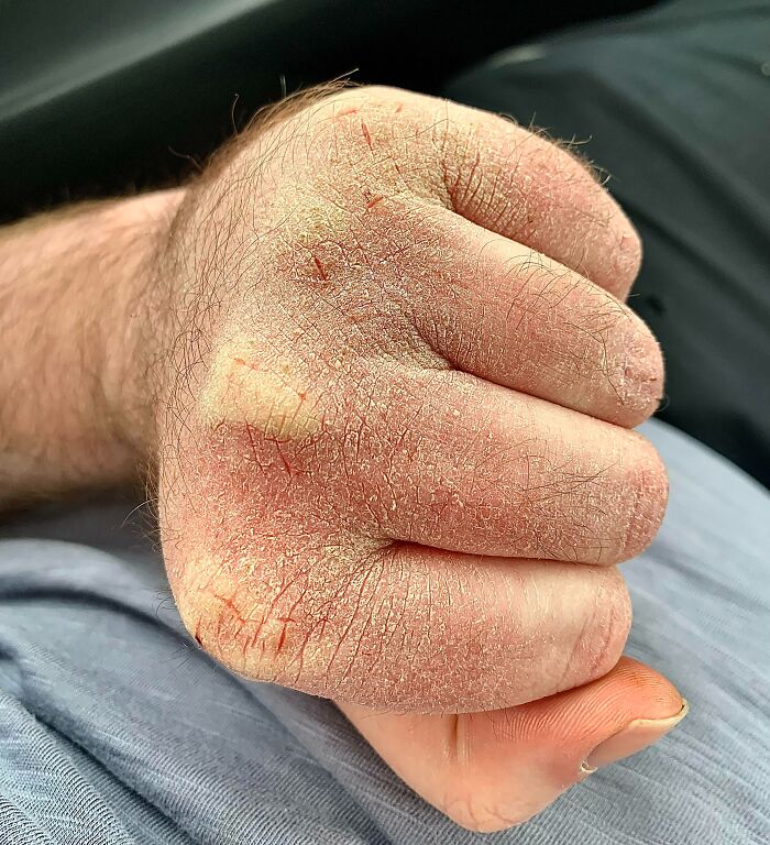people having a bad day at work - dry hands reddit