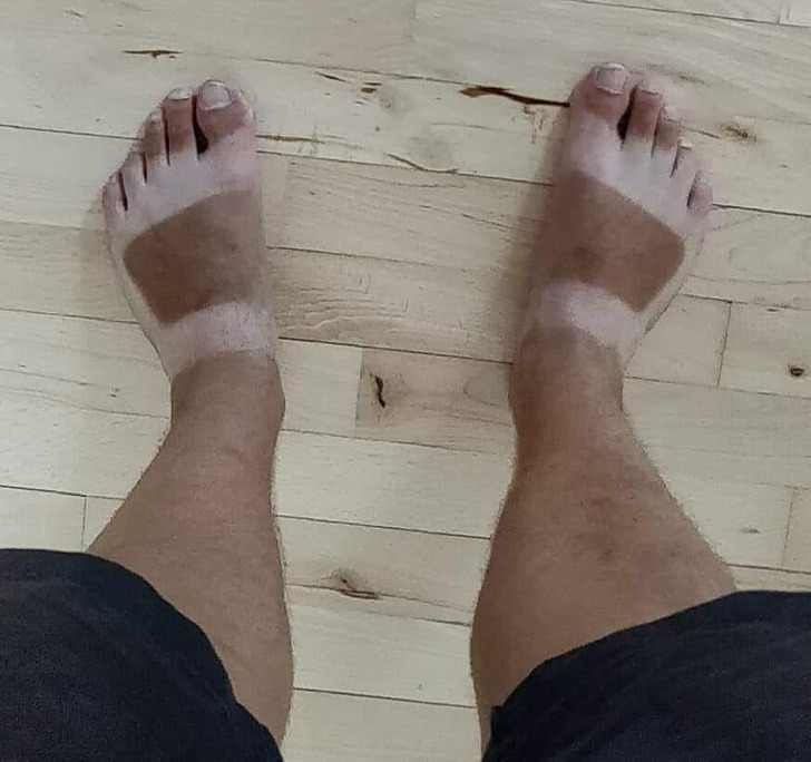 “Tan lines from the time I was living in Vietnam.”