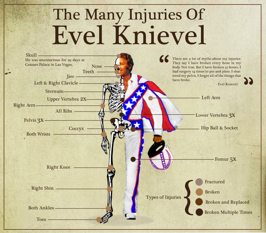 The Many Injuries Of Evel Knievel