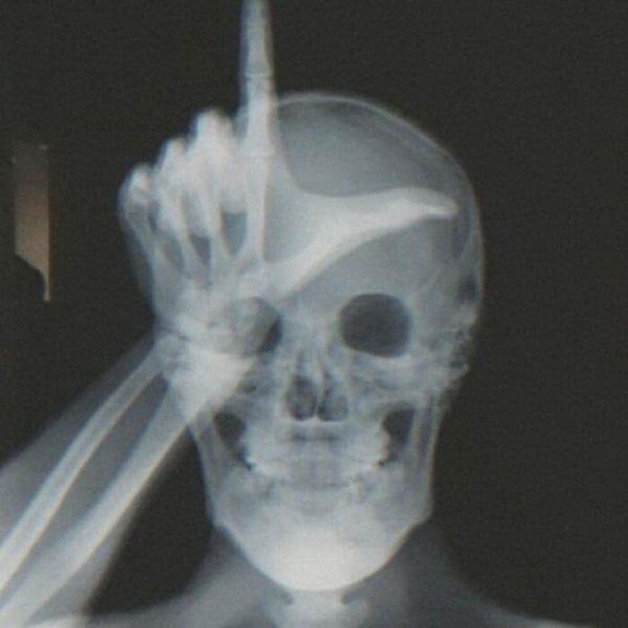 pics that prove people are weird - skeleton x ray aesthetic