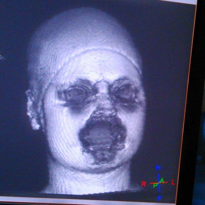 mildly terrifying images - head - RPa L