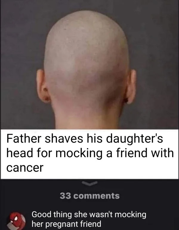 Pics To Make You Hold Up - female head back - Father shaves his daughter's head for mocking a friend with cancer 33 Good thing she wasn't mocking her pregnant friend