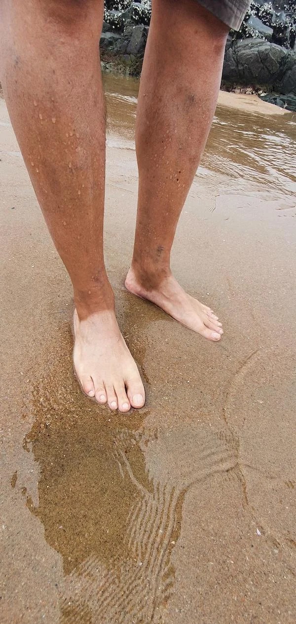 moments when life sucked -  white feet tan legs