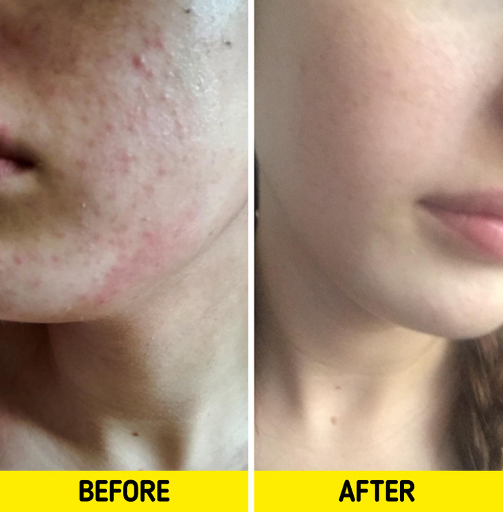 14 Products That Could Upgrade Your Life.