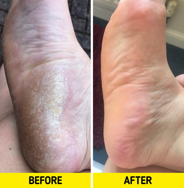 14 Products That Could Upgrade Your Life.