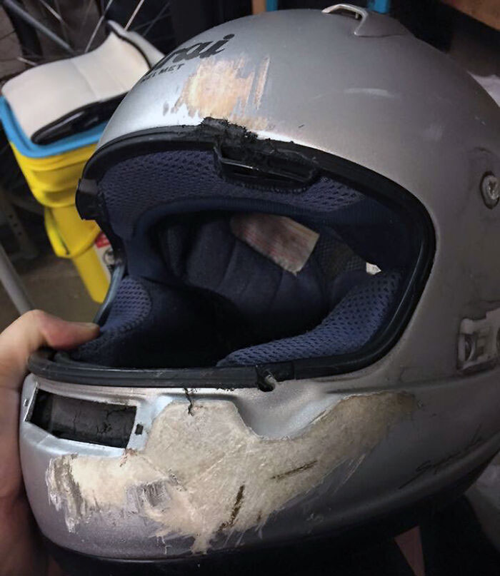 This Is Why You Wear A Full Helmet. My Friend Was Hit By Someone Who Ran A Red Light. If He Had Wore A Skull Cap, He'd Have No Lower Jaw