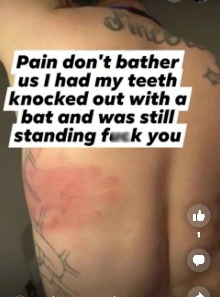 shoulder - to Pain don't bather us I had my teeth knocked out with a bat and was still standing fuck you 1