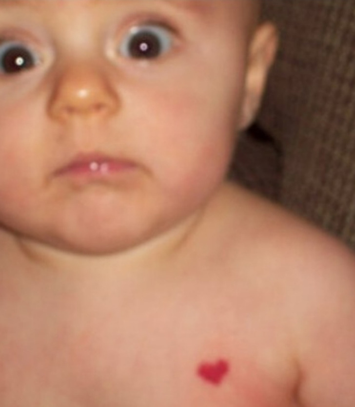 “My daughter has a heart-shaped birthmark.”