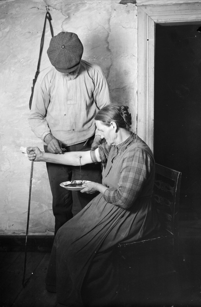 history pics and stories - bloodletting treatment