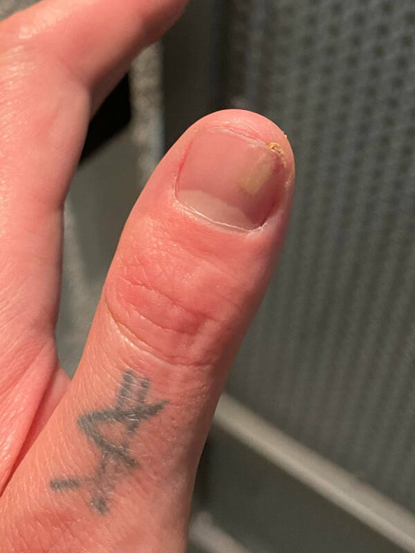 “Got a splinter under my thumb nail.”