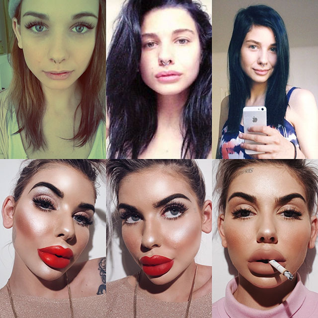 people who took plastic surgery too far - Fris