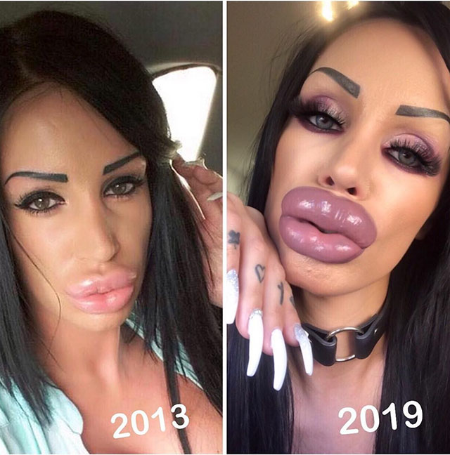 people with plastic surgery - 250 2013 2019