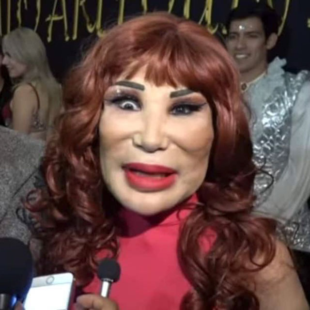 people who took plastic surgery too far