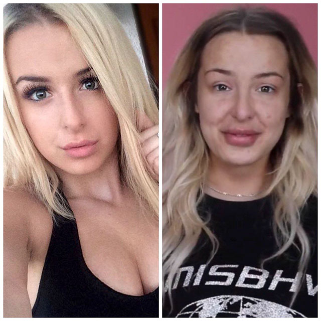 tana mongeau before and after