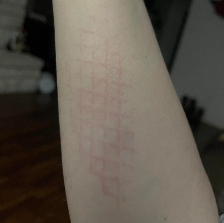 “Tried to catch the HOT air fryer basket that I dropped as I was taking it out.”