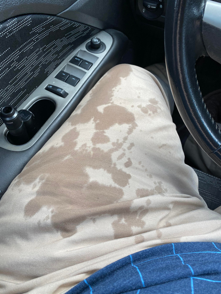 “I tripped while getting out of the car and holding an energy drink. This was 3 minutes before my meet-and-greet meeting with my new job’s CEO.”