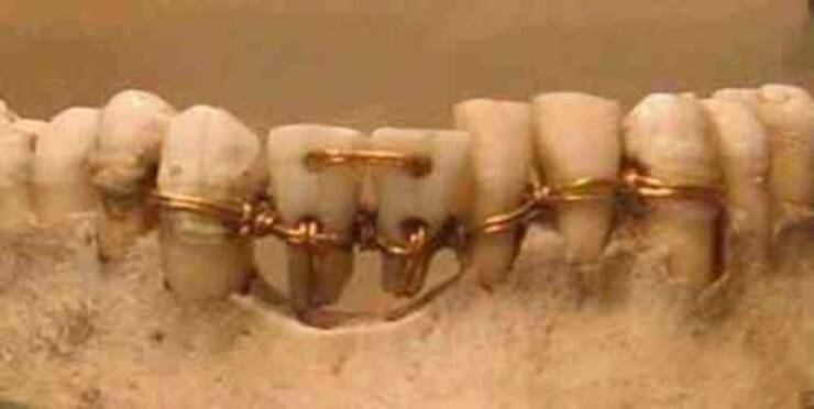 fascinating photos - ancient egyptian dental work
