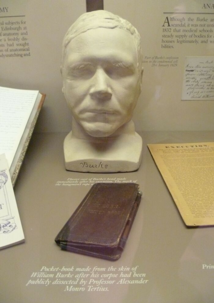 wtf facts - book bound in human skin - My al subjects for Edinburgh at fanatomy and e a freshly dis sts had sought on of anatomical dysnatching and T Burke Plaster ant of Burke's head made mediately after his execution. The mark of Pocketbook made from th