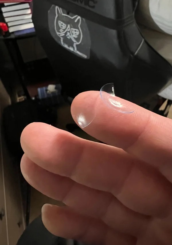 “This contact lens split apart in my eye. Has this happened to anyone else?”