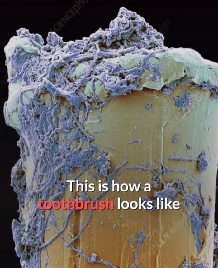 disturbing facts - toothbrush under microscope - Sciencedh This is how a toothbrush looks photote