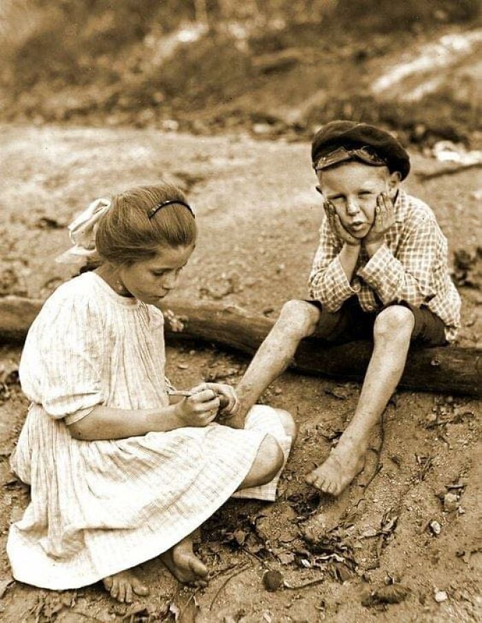 Pulling Out A Splinter In 1910